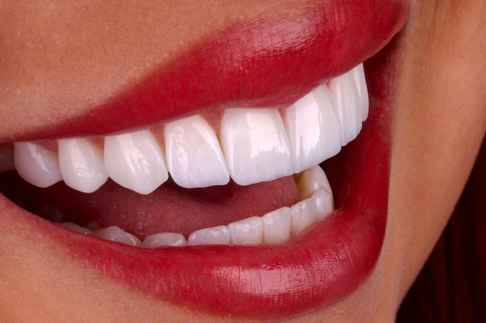 Medicina Dentária Estética